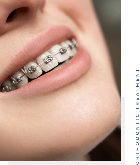 Orthodontic Treatment 1