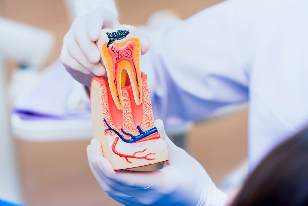 Understanding-the-Symptoms-of-Root-Canal-Infection--A-Comprehensive-Guide